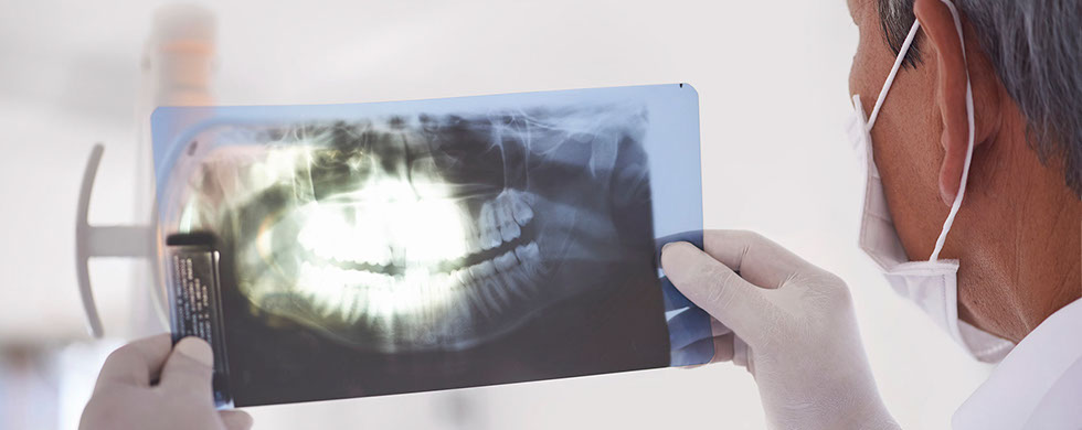 Implantes Oseos Osteocor