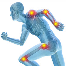 Implantes Oseos Osteocor