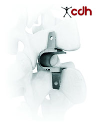 Implantes Oseos Osteocor