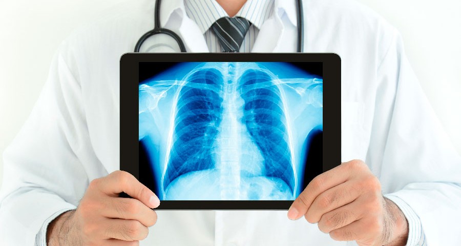 Implantes Oseos Osteocor