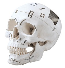 Implantes Oseos Osteocor