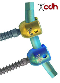 Implantes Oseos Osteocor